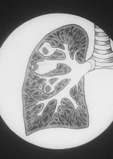 Anime poster: Preventing Tuberculosis
